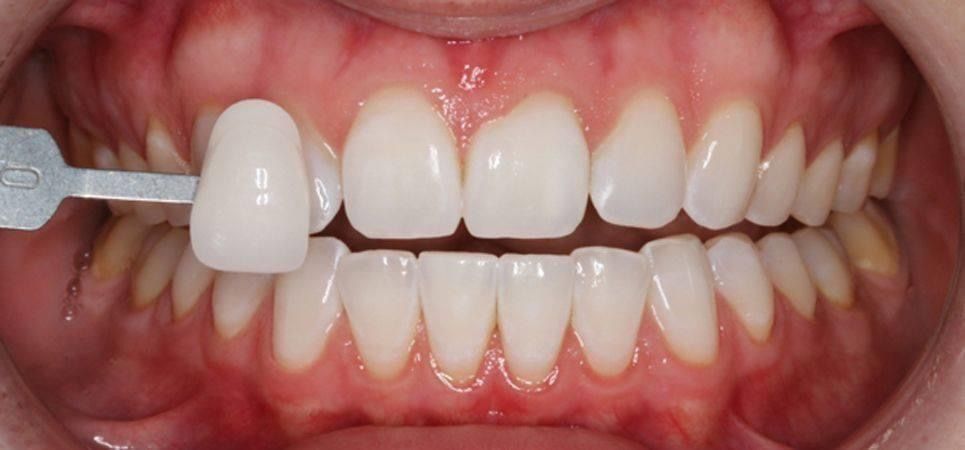 4b6b3c395763ea28a2c04777fc8ef4d2