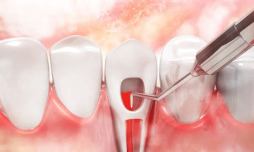 ae267ae4827f862f766457280eb104c3